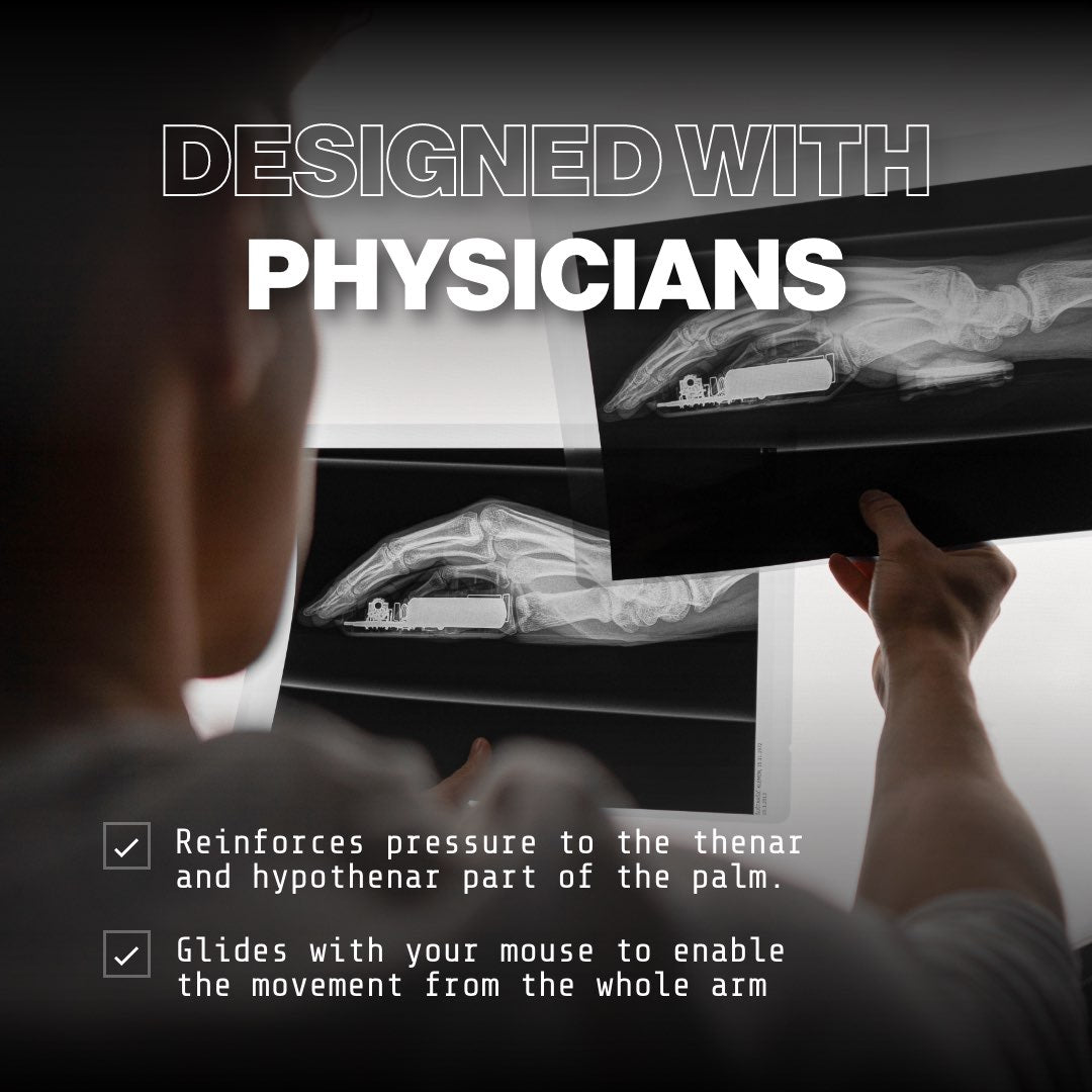 Enhanced Wrist Support Deltahub Carpio 2.0 Wrist Rest Fantech Australia